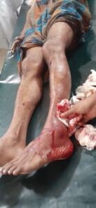 কোম্পানীগঞ্জে এবার স্বেচ্ছাসেবক লীগ নেতার ওপর হামলা, গুলি